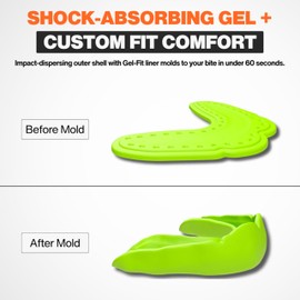 Shock Doctor Slim Mouthguard 2.4mm Thin Mouth Guard. Microfit for Football, Hockey, Lacrosse, Baseball, Softball, Basketball and More. Youth and Adults. Also for Night Guard Teeth Grinding