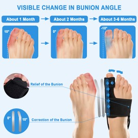 PIWOSGOL Hallux Valgus Correction, 2 x Hallux Valgus Correction Splint with 4 x Toe Separators for Toe Straightening for Day and Night, Hallux Valgus Bandage for Men and Women