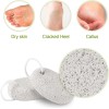Asqraqo 2PCS Natural Pumice Stone Callus Remover Foot File