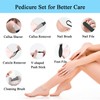 Electric Foot Callus Remover- Long Service Time, Rechargeable Electronic Foot