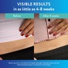 ScarAway Advanced Clear Silicone Scar Sheets, Medical Grade Silicone Strips