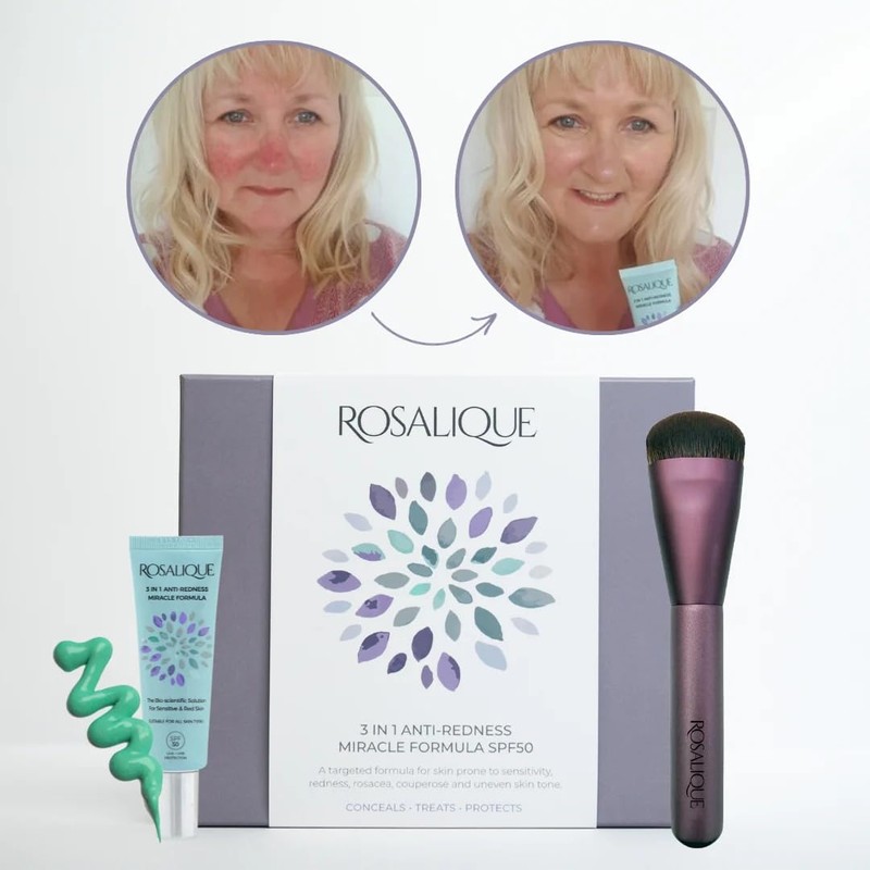 Rosalique Gift Set: The Ultimate Skincare Duo for Sensitive and