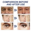 Crema De Retinol, 15% Ha, Colágeno, Reafirmante Antienvejeci