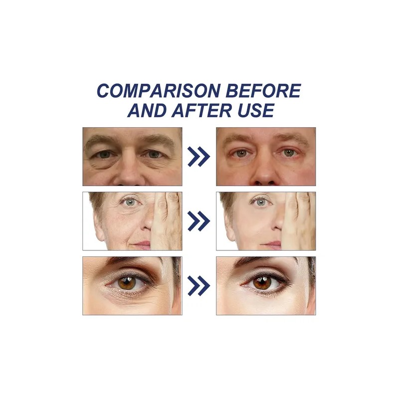 Crema De Retinol, 15% Ha, Colágeno, Reafirmante Antienvejeci