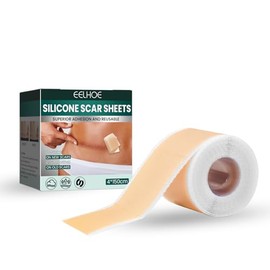 Silicone Scar Sheets (1.6"x60")