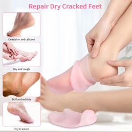 Aluroice 2 Pairs Silicone Moisturizing Socks for Dry Cracked Feet Women, Soft Gel Pedicure Foot Spa Aloe Socks, Anti-Slip Moisturizer Socks for Dry Cracked Feet Overnight Foot Care Pink&White