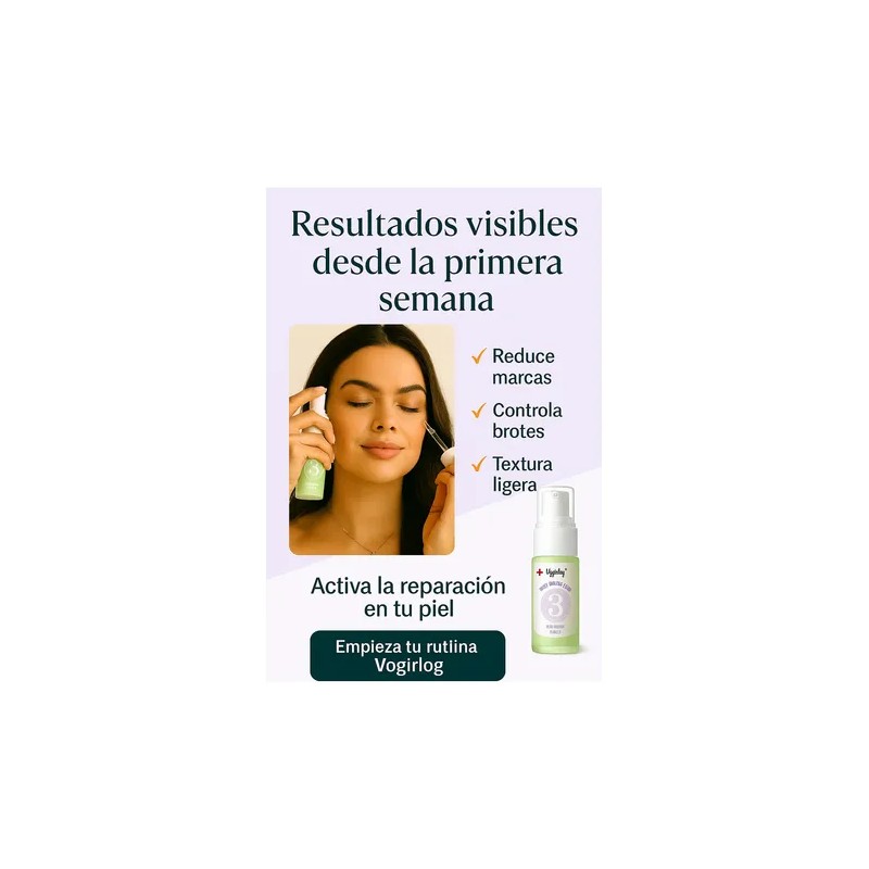 Kit Skincare Antiacné Vogirlog 5 Pasos Control Grasa