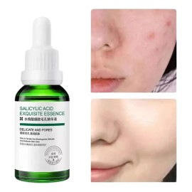 Sérum Facial Universo en Linea Ácido Salicílico Antiacné 30ml Piel Todo Tipo