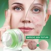 Hydrating Cream 50g - 3% For Zits & Blackhead Improvement,