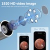 Ear Irrigation Flushing Cleanr and 1920P Ear Cleaner with Camera