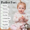 Monkey Balm All Natural Skin Care for Kids, Babies, Adults