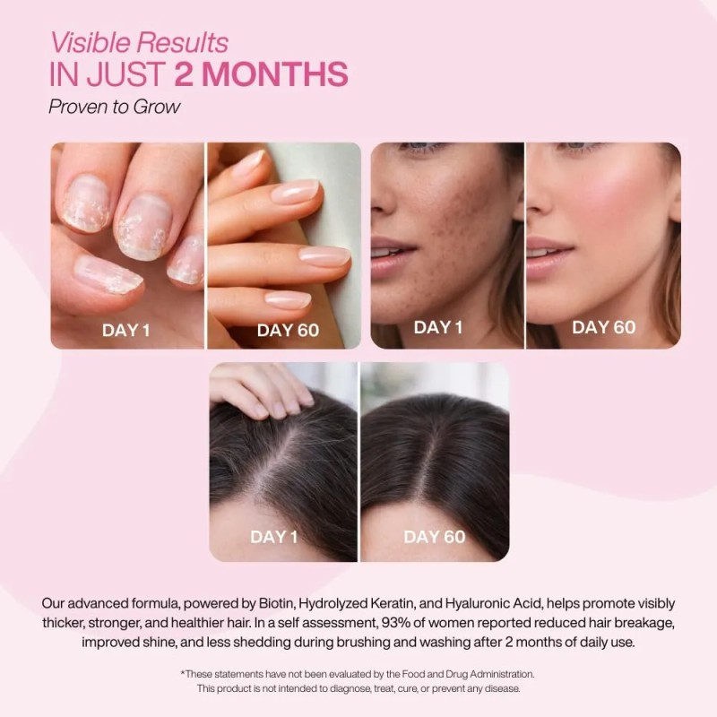 Vitamina Biotina Crecimiento Cabello Beau