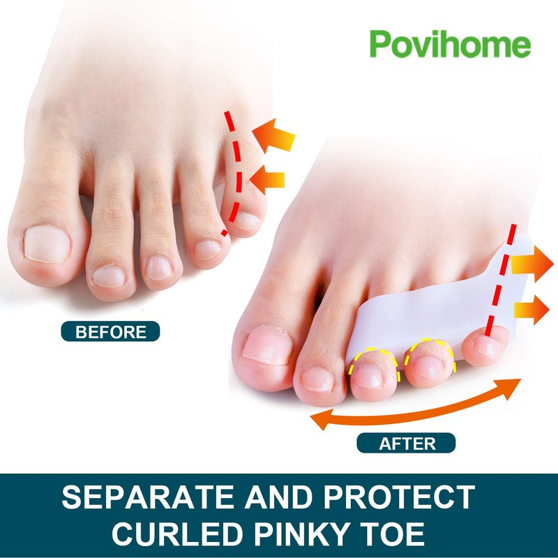 Povihome 10 Pack Pinky Toe Separator and Protectors, Triple Gel