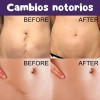 8 Parches Silicona Reutilizables Cicatrices Grado Medico F