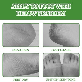 7 Paar Fußmaske Hornhaut Socken Fussmaske Hornhautentfernung Feuchtigkeitsspendend Fussmaske Fussmaske Socken Fußpflege-Fußmaskensocken für Männer und Frauen (Aloe Vera)