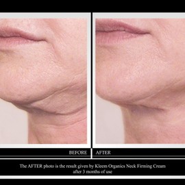 Neck Firming Cream for Sagging Skin - Anti-Aging with Retinol and Panthenol Moisturizing & Décolleté to Improve Elasticity, Smooth Fine Lines, and Improve Wrinkles 1.7 Fl Oz / 처진 피부를 위한 크림 넥 피밍 - 레티놀과 판테놀이 함유된 안티에이징 탄력을 개선하고 잔주름을 매끄럽게 하며 주름을 개선하는 보습 & 데콜레 1.7 Fl Oz