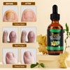 Ginger nails are oils, a ginger manicure, ginger fingernails nail