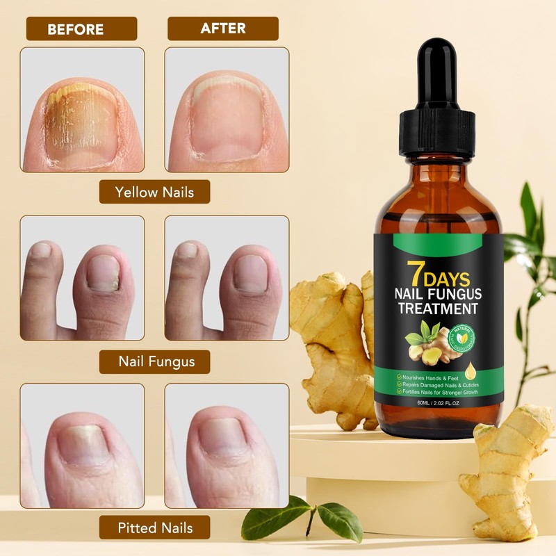 Ginger nails are oils, a ginger manicure, ginger fingernails nail