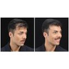Kmax Keratin Hair Fiber 50 Gr Refill Nachfüllbeutel -Haarverdichter -