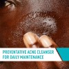 Limpiador Facial Cerave Para El Control Del Acné, Tratamient