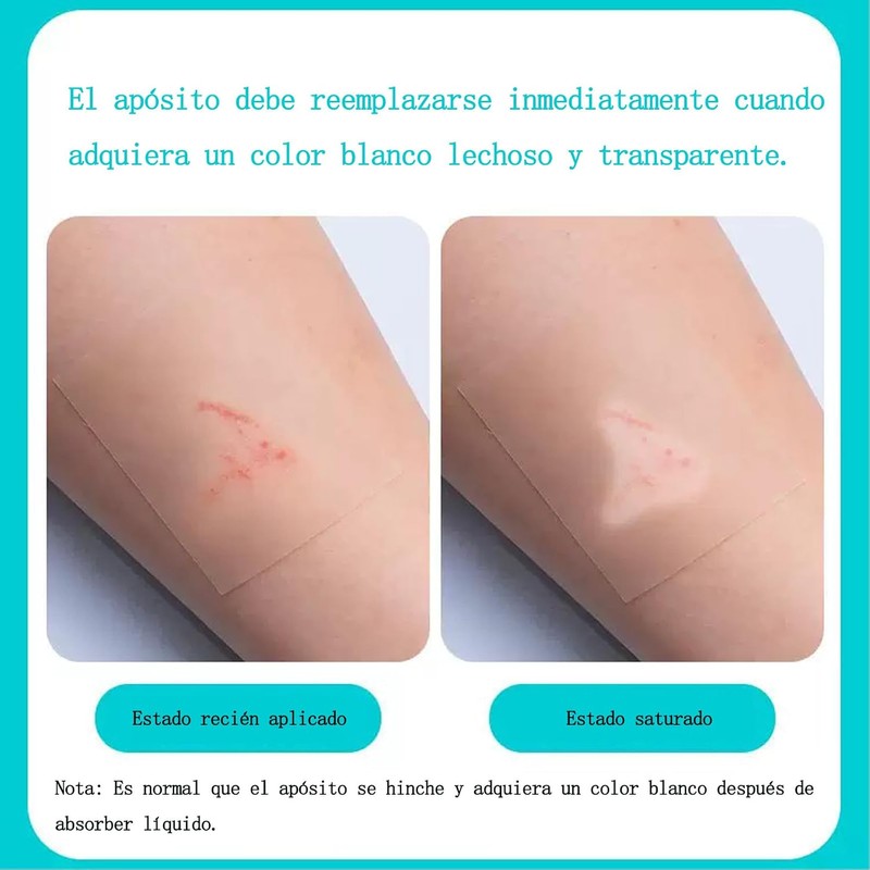 Hydrocolloid Bandage Roll, Waterproof Cut-to-Size Medical Grade Hydrocolloid Roll (2