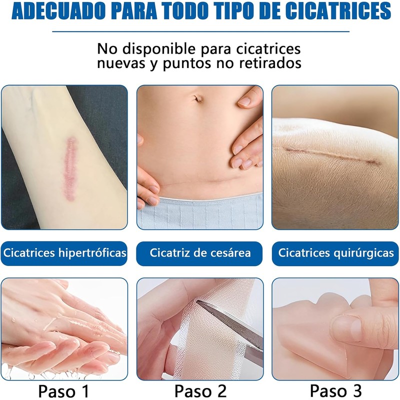 parches de silicona para cicatrices,cinta de silicona para cicatrices, elimina