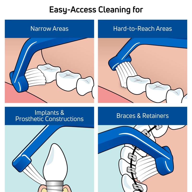 TePe Universal Care Angled Soft-Bristle Toothbrush, Small-Head Orthodontic Toothbrush