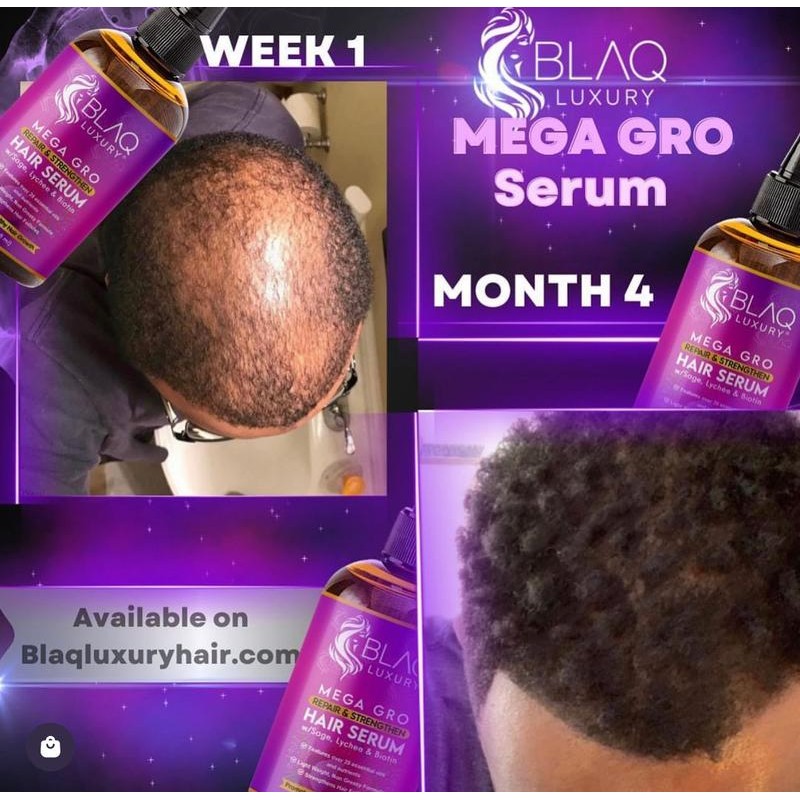 BLAQ LUXURY Mega Gro Repair and Strengthen Hair Serum