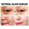 2pcs 30ml Retinoid Serum Minimizes Fine Lines Firming Anti Wrinkle