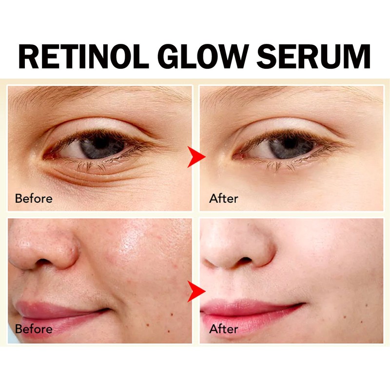 2pcs 30ml Retinoid Serum Minimizes Fine Lines Firming Anti Wrinkle