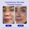 Rejuvaskin Rejuvasil Gel de Silicona para Cicatrices 15 ml -