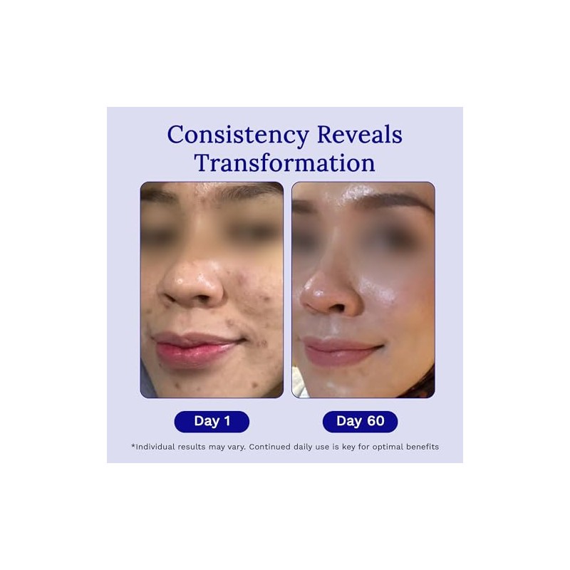 Rejuvaskin Rejuvasil Gel de Silicona para Cicatrices 15 ml -