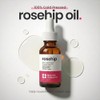 Rosehip Oil by Natural Outcome for Women - 1 oz