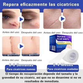 Parches de silicona para cicatrices, cinta para cicatrices de 3 metros, promueven la cicatrización de heridas, adecuados para reparar y eliminar cicatrices nuevas y viejas, quemaduras y queloides