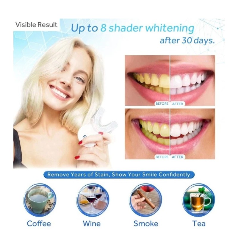 EZGO Teeth Whitening Kit Tooth Whitener with LED Light
