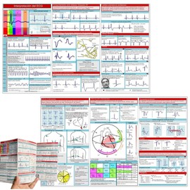 SPHERETRON ECG Pocket Manual Pack of 2 ECG Pocket Guide ECG Pocket Card Double Sided ECG Rhythm Interpretation ECG Rhythm Pocket Card ECG Card Interpretation of ECG Fast Heart Analysis