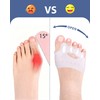Jalopink Upgrade Silicone Toe Separators, Spacers Bunion Corrector for Women