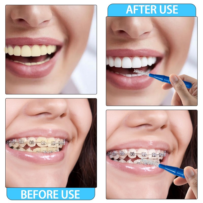 DMwespe 88 Pcs Interdental Brush Braces Brush, Dental Tooth Flossing
