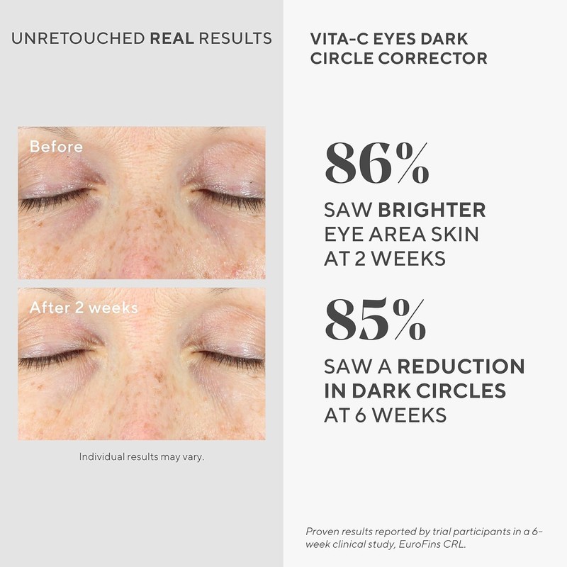 Murad Vita-C Eyes Dark Circle Corrector, 0.5 Fl Oz