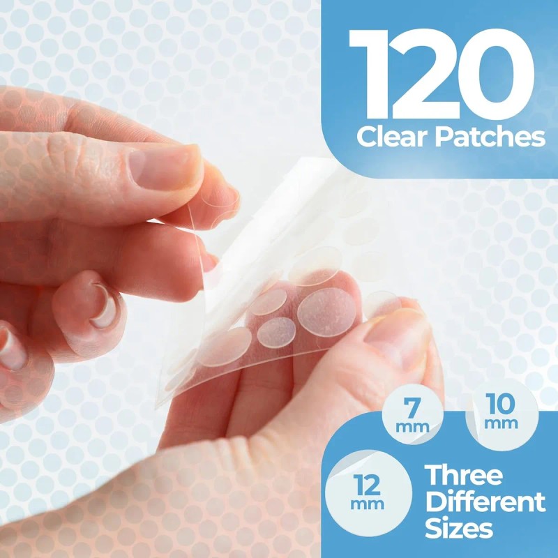 Parches Para Espinillas Para La Cara (paquete De 120), Parch