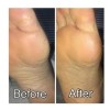 Urea Al 30% En Gel-crema Hidratante 500 Ml