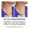 Crema Reafirmante Para El Cuello (2 Unidades), Crema Reafirm