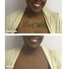 Dermaflage Tattoo Cover Up Makeup (Dark) - Bruise Full Coverage