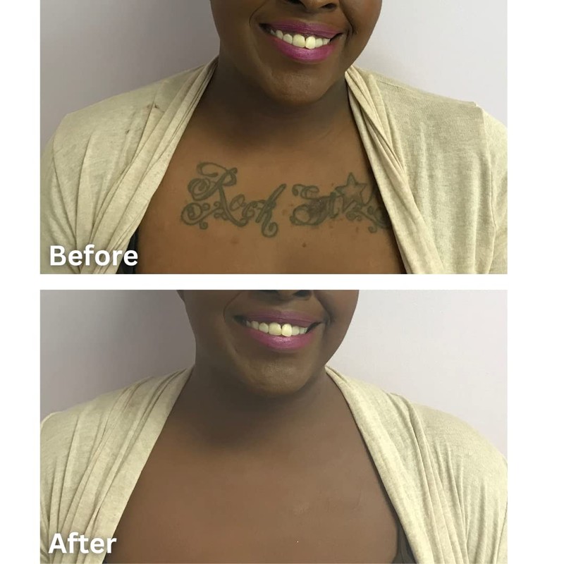Dermaflage Tattoo Cover Up Makeup (Dark) - Bruise Full Coverage