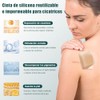 Parches de Silicona para Eliminar Cicatrices, Tratamiento Profesional para Cicatrices