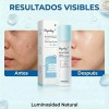 Loción Con Niacinamida Hidratante 100ml Todo Tipo De Piel Día/noche