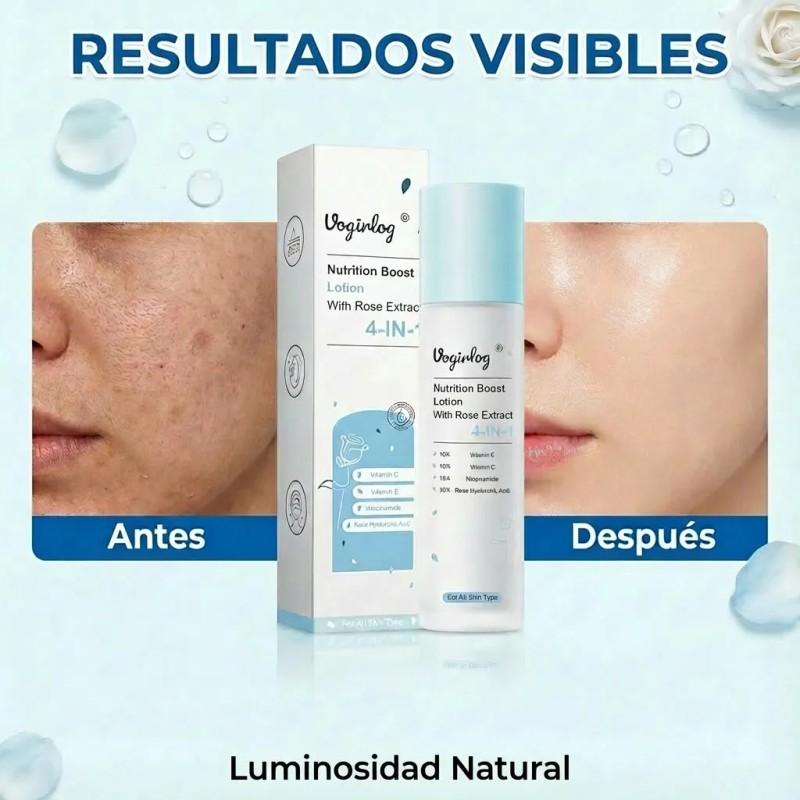 Loción Con Niacinamida Hidratante 100ml Todo Tipo De Piel Día/noche