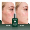 Overnight Repair Serum，Derma Botanica Overnight Serum – Luxurious Night Facial