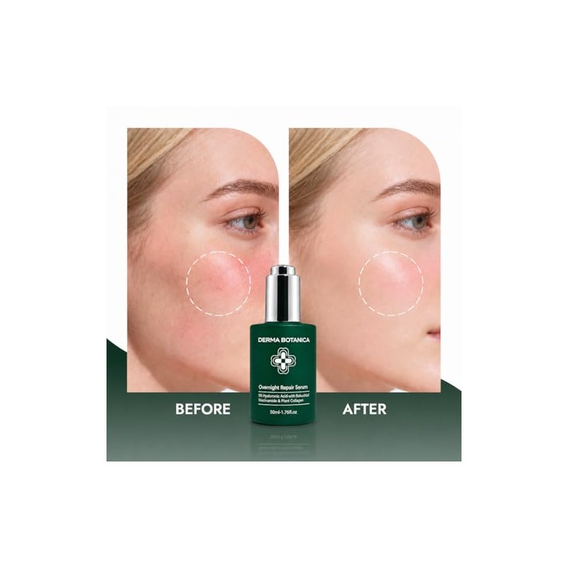 Overnight Repair Serum，Derma Botanica Overnight Serum – Luxurious Night Facial