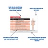 STEMI 12 Lead Reference and 12 Lead EKG (ECG) Placement
